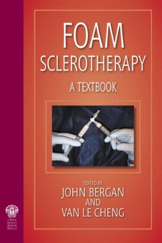 Foam Sclerotherapy: A Textbook, by John J. Bergan, Van Le Cheng