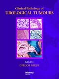 Clinical Pathology of Urological Tumours