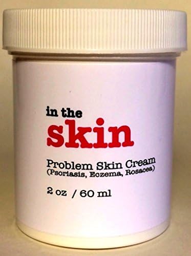 In the skin Problem Skin Cream is the best lotion for eczema; Fast Acting, Plant Based and Non Toxic, 100% Money Back Guarantee, No Risk, No Synthetic Ingredients, Non Steroidal.