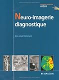 Neuro-imagerie diagnostique