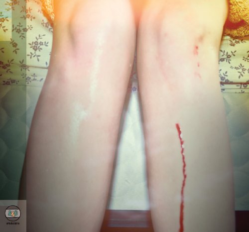 Los Campesinos! Foto 2