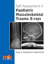 Self-assessment in Paediatric Musculoskeletal Trauma X-rays