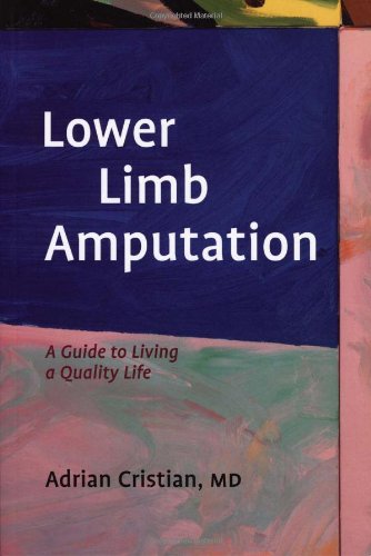 Lower Limb Amputation1932603255 : image