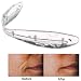 Angellift  Dermastrips, 2 Medical Surgical Grade Non surgical Lifts,  Box