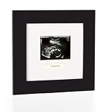 Pearhead Sonogram Frame, Black