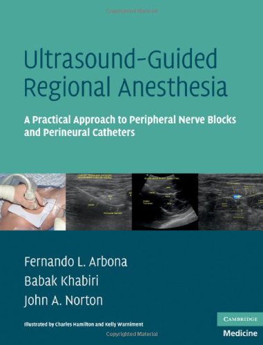 Ultrasound-Guided Regional Anesthesia: A Practical Approach to Peripheral Nerve Blocks and Perineural Catheters (Cambridge Medicine)