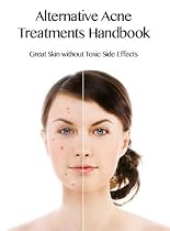 Click to Download Free Kindle Book -> Alternative Acne Treatments Handbook - Great Skin Without Toxic Side Effects (Health and Wellness Series)