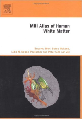 MRI Atlas of Human White Matter On Sale