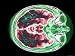 Magnetic Resonance Imaging Head at Level of Orbits Photographic Poster Print, 16x12
