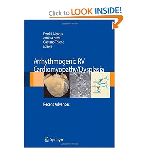 Arrhythmogenic RV Cardiomyopathy Dysplasia: Recent Advances by Frank I. Marcus, Andrea Nava, and Gaetano Thiene