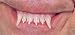 Teeth, Glow Werewolf/Witch