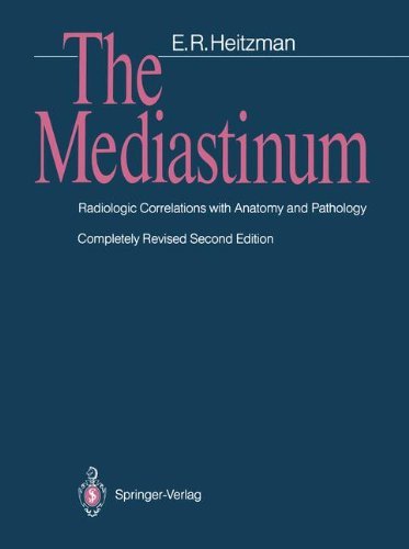 The Mediastinum: Radiologic Correlations with Anatomy and Pathology
