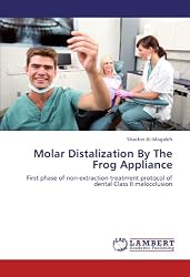Molar Distalization By The Frog Appliance: First phase of non-extraction treatment protocol of dental Class II malocclusion