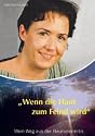 Wenn die Haut zum Feind wird