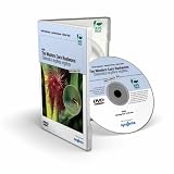 The Western Corn Rootworm Diabrotica Virgifera Virgifera DVD