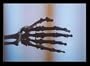 Metacarpus (Institutional Use - Library/High School)