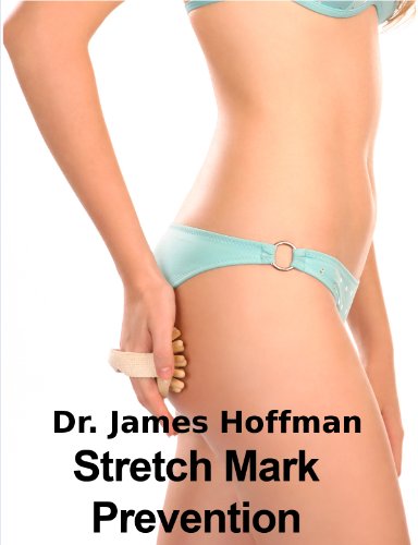 how to get rid of stretch marks