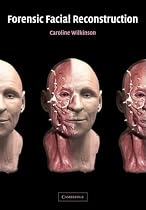 Forensic Facial Reconstruction