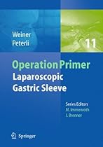 Laparoscopic Gastric Sleeve (Operation Primers)