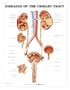 Urinary Tract Diseases Chart