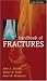 Handbook of Fractures