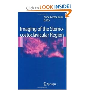 Click here to buy Imaging of the Sternocostoclavicular Region by Anne Grethe Jurik.