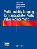 Multimodality imaging for transcatheter aortic valve replacement