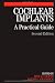 Cochlear Implants: A Practical Guide