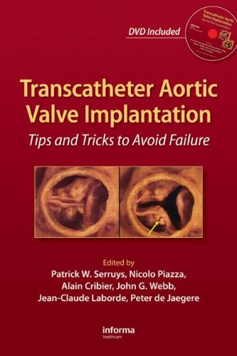 transcatheter aortic valve implantation tips and tricks to avoid failure