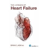 the 4 stages of heart failure