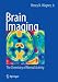 Brain Imaging: The Chemistry of Mental Activity