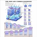 The Skin and Common Disorders Anatomical Chart