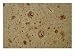 Alzheimers Disease, Bielchowsky Stain X64 Art Photographic Poster Print by G. W. Willis, 16x12