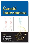 Carotid Interventions