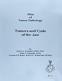 Tumors and cysts of the jaws