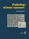 Pathology of bone tumours: Personal experience