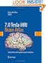 7.0 Tesla MRI Brain Atlas: In Vivo Atlas with Cryomacrotome Correlation