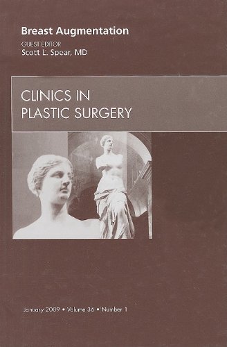Breast Augmentation, An Issue of Clinics in Plastic Surgery (The Clinics: Surgery)
