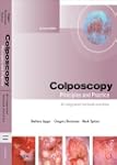 Colposcopy: Principles and Practice