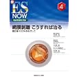 網膜剝離こうすれば治る<br>門之園 一明担当編集委員 <br>メジカルビュー社<br>12600円<br>ISBN:9784758310789