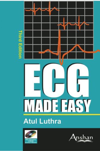ECG Made Easy 3E ECG Made Easy 3E