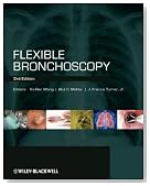 Flexible Bronchoscopy