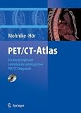 PET/CT-Atlas: Ein interdisziplinärer Leitfaden der onkologischen PET/CT-Diagnostik (German Edition)