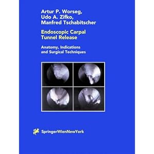 Endoscopic Carpal Tunnel Release