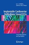 Implantable Cardioverter Defibrillator Stored ECGs: Clinical Management and Case Reports