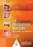 La Muqueuse Buccale : de la clinique au traitement