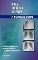 The Chest X-Ray Survival Guide