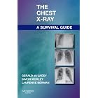The Chest X-Ray: A Survival Guide by Gerald de Lacey MA FRCR, Simon Morley FRCR, and Laurence Berman MB BS FRCP FRCR