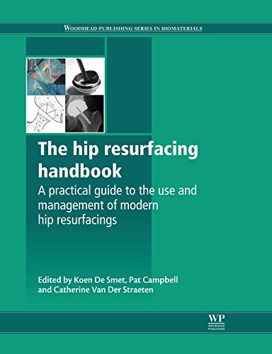 The Hip Resurfacing Handbook: A Practical Guide to the Use and Management of Modern Hip Resurfacings (Woodhead Publishing Series in Biomaterials)
