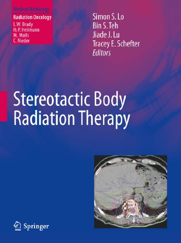 Stereotactic Body Radiation Therapy (Medical Radiology)